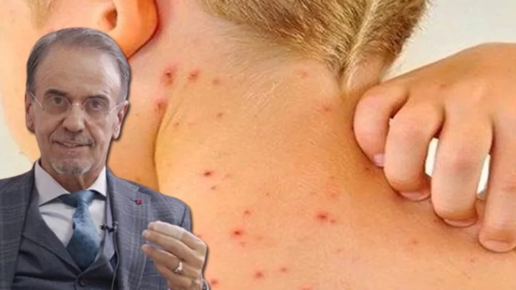 Mehmet Ceyhan’dan Kızamık uyarısı